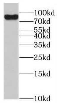 RAP1GAP Antibody