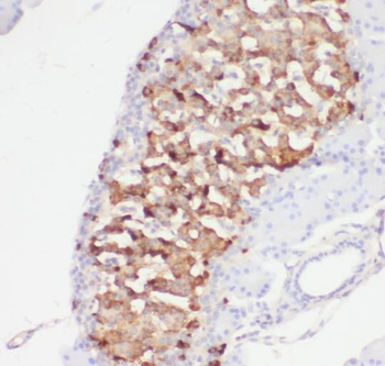 RAP1GAP Rabbit Polyclonal Antibody