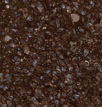 RAP1GDS1 Rabbit Polyclonal Antibody
