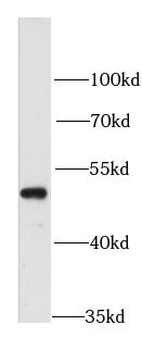 RARA Rabbit Polyclonal Antibody