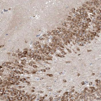 RARB Antibody
