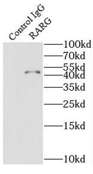 RARG Rabbit Polyclonal Antibody