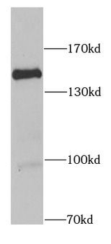 RASGRF1 Antibody