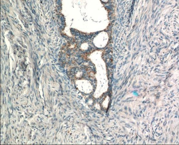 RASGRP3 Rabbit Polyclonal Antibody