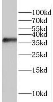 RASSF4 Rabbit Polyclonal Antibody