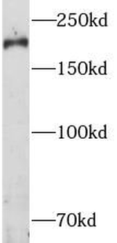RB1CC1 Antibody