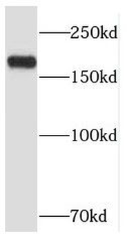RB1CC1 Antibody