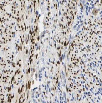 RBBP4 Rabbit Polyclonal Antibody