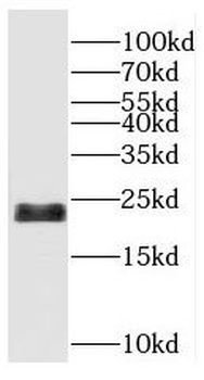RBBP9 Antibody