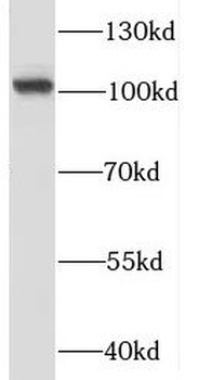 RBM15 Antibody