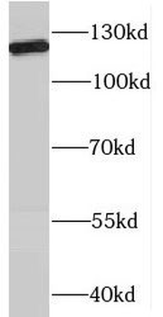 RBM19 Rabbit Polyclonal Antibody