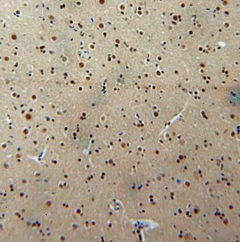 RBM26 Rabbit Polyclonal Antibody