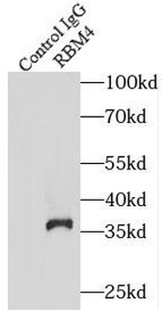 RBM4 Rabbit Polyclonal Antibody