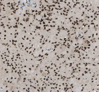 RBM4 Rabbit Polyclonal Antibody