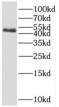 RBM41 Rabbit Polyclonal Antibody