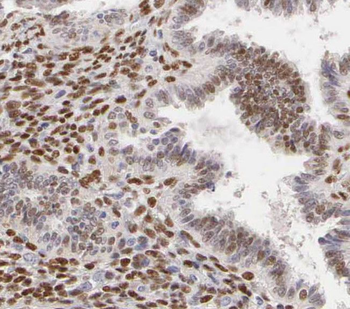 RBM41 Rabbit Polyclonal Antibody