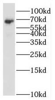 RBM47 Antibody