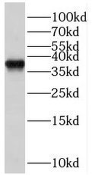 RBM4B Antibody