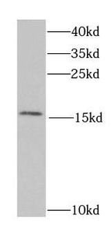 RBP2 Rabbit Polyclonal Antibody