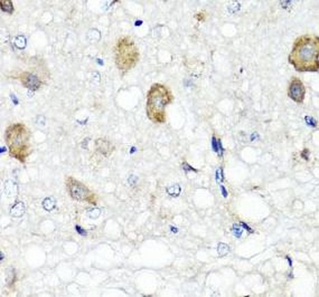 RBP2 Rabbit Polyclonal Antibody