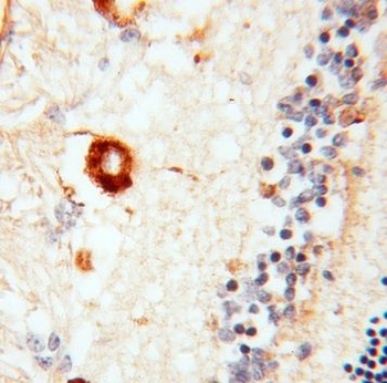 RBP3 Rabbit Polyclonal Antibody