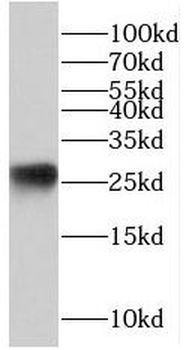 RCAN1 Rabbit Polyclonal Antibody