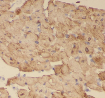 RCAN1 Rabbit Polyclonal Antibody
