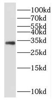 EBAG9 Rabbit Polyclonal Antibody