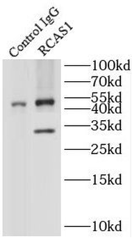 EBAG9 Rabbit Polyclonal Antibody