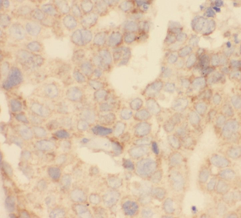 EBAG9 Rabbit Polyclonal Antibody