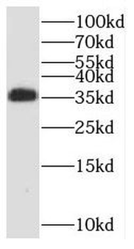 RCBTB1 Antibody