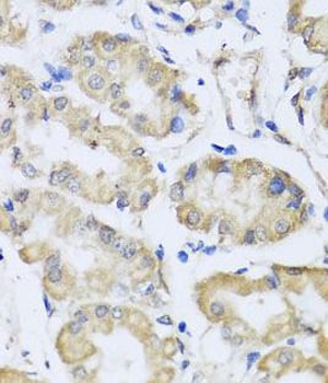 RCN2 Rabbit Polyclonal Antibody