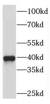 RDH10 Rabbit Polyclonal Antibody