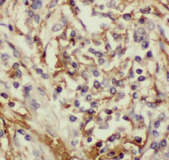 RDH10 Rabbit Polyclonal Antibody