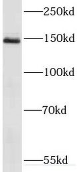 RECQL4 Rabbit Polyclonal Antibody