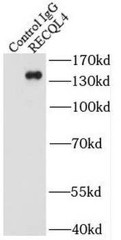 RECQL4 Rabbit Polyclonal Antibody