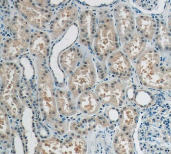 RECQL4 Rabbit Polyclonal Antibody