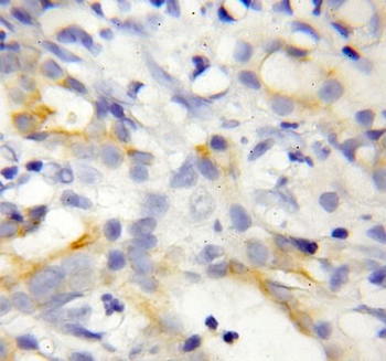 REEP6 Rabbit Polyclonal Antibody