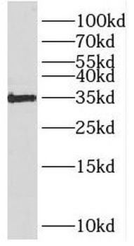 RNLS Antibody