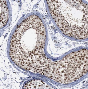REXO4 Rabbit Polyclonal Antibody