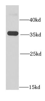 RFC5 Antibody