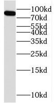 RFWD3 Antibody