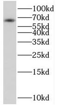 RGS14 Rabbit Polyclonal Antibody