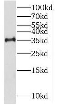 RHBDD1 Antibody