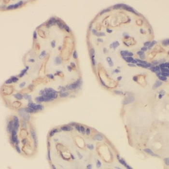 RHOBTB3 Rabbit Polyclonal Antibody