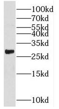 RHOT2 Antibody