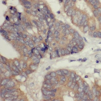 RIBC2 Rabbit Polyclonal Antibody
