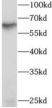 RIOK3 Antibody