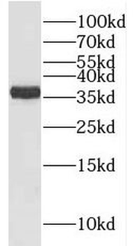 RLBP1 Antibody