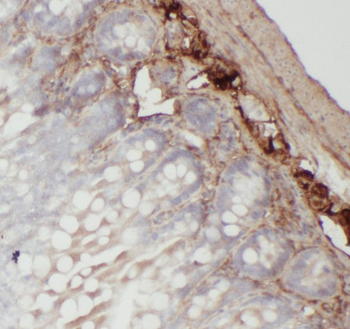 RMND5B Rabbit Polyclonal Antibody